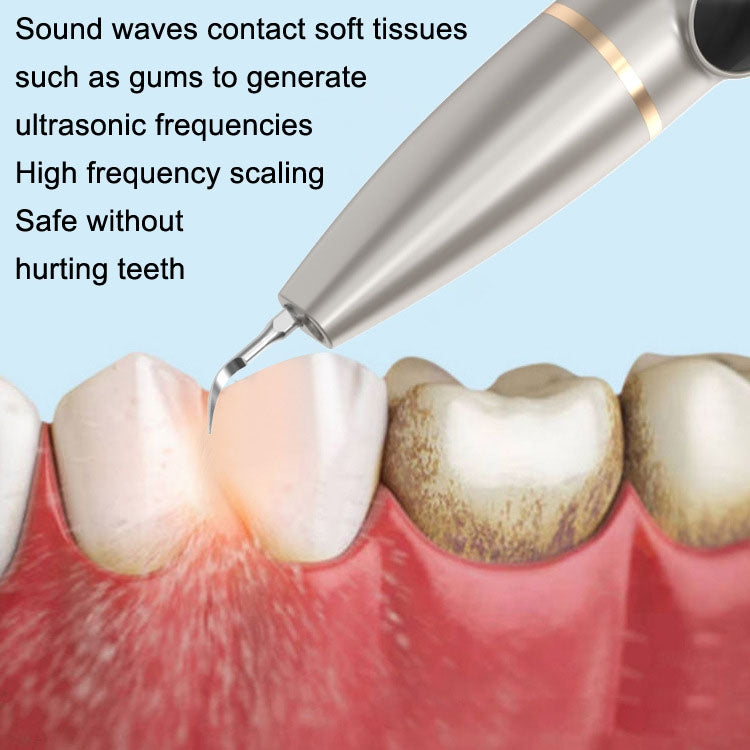 Tartar and Calculus Remover Oral Cleaning Ultrasonic Scaler Electric Visual Scaler(Champagne) - Oral Irrigators by buy2fix | Online Shopping UK | buy2fix